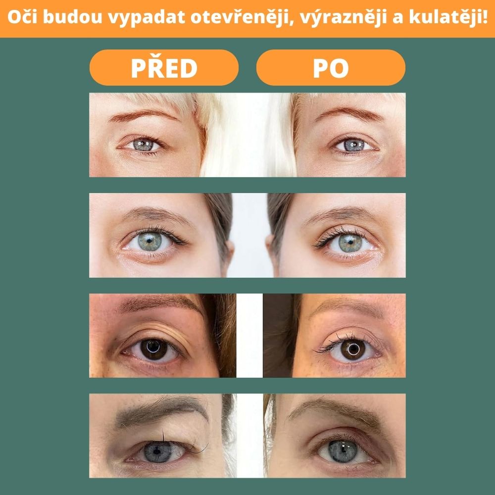 Szemhéj emelő szalagok (400 db)