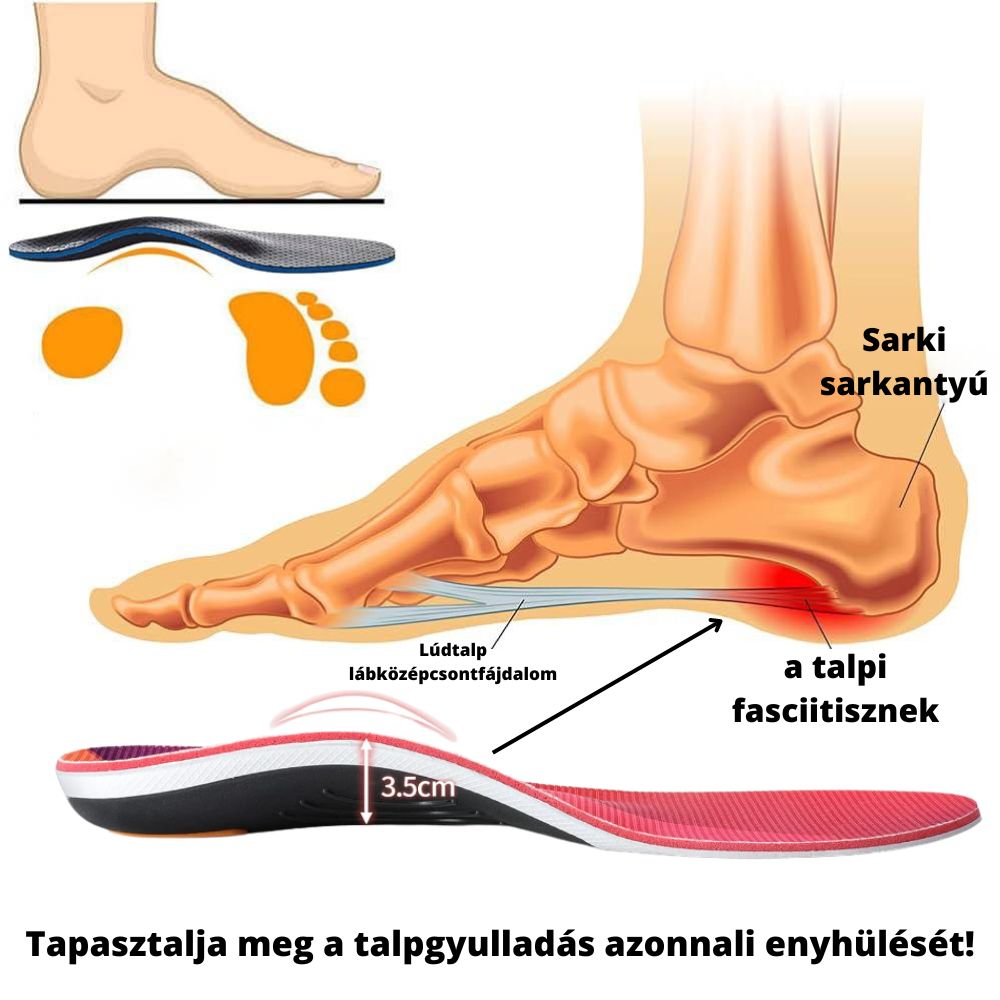 Ortopéd talpbetét (2 pár)