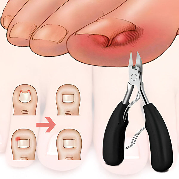 Professzionális körömápoló készlet NAILPRO