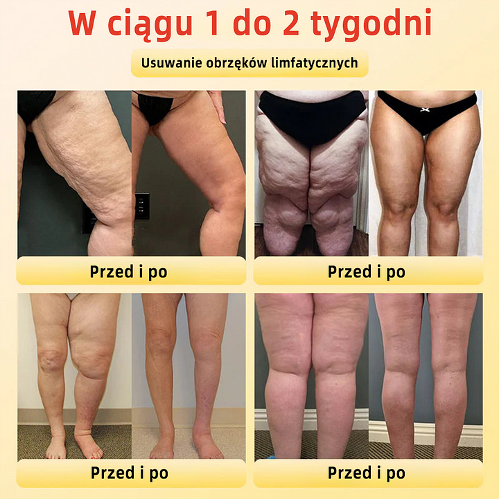 🔥 Titán orvosi szálas modellező rövidnadrág önmelegítővel és turmalinnal (⏰ Utolsó esély a kedvezményre - utolsó 30 perc! ⏰)✈️