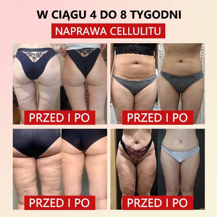 mikrovibrációs féreghajtás erősítő öv a Ciała❤️ formázásához (plasztikai sebészek által ajánlott)