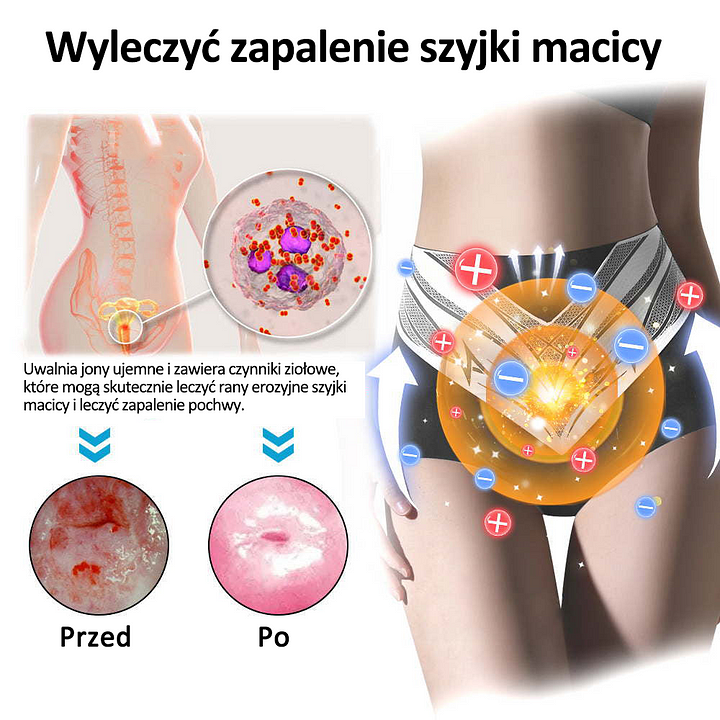 🔥 Titán orvosi szálas modellező rövidnadrág önmelegítővel és turmalinnal (⏰ Utolsó esély a kedvezményre - utolsó 30 perc! ⏰)✈️