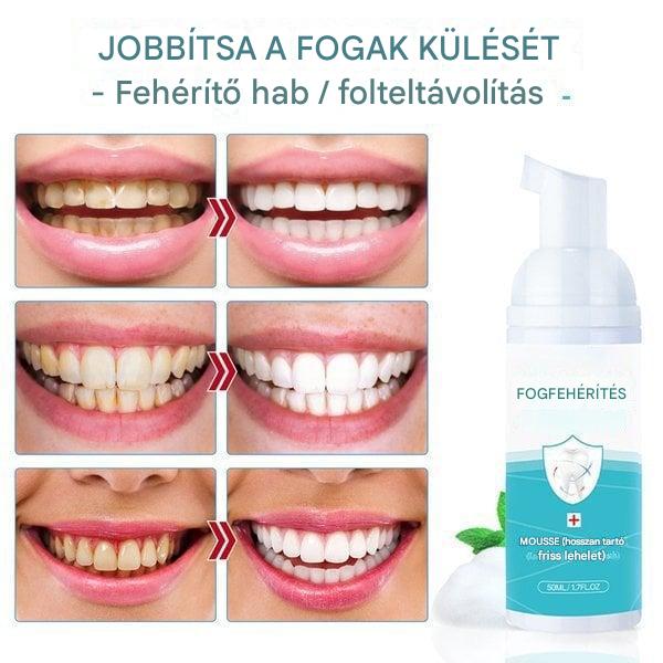 Fogtisztító mousse szájápolás 🦷✨✨