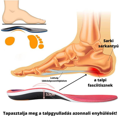 Ortopéd talpbetét (2 pár)