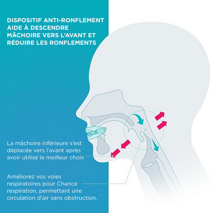 Rugalmas és alkalmazkodó ortézis horkolás és alvási apnoe ellen